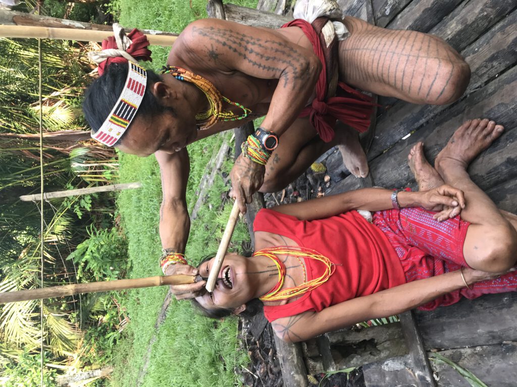 Anspitzen der Zähne bei den Mentawai