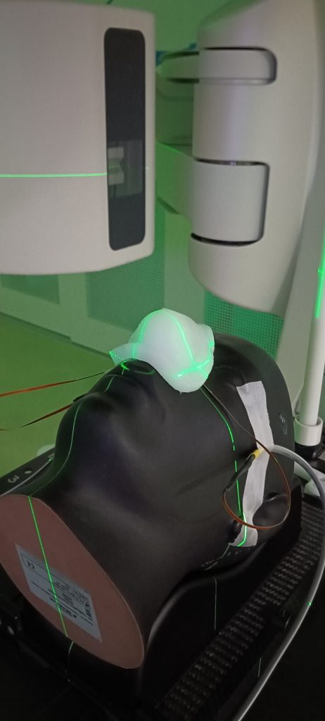 Phantomkopf mit auf der Nase aufgelegtem, 3D-getrucktem Bolus aus Silikon. Der Bolus wurde auf Basis eines 3D Scans von der Oberfläche des Gesichts am Computer geplant und dann im gemeinsam mit der ACMIT entwickelten 3D Drucker hergestellt. Er ermöglicht eine genaue Strahlendosierung an der Hautoberfläche der Nase und soll bei speziellen Tumortypen zum Einsatz kommen. | © Lukas Warnung